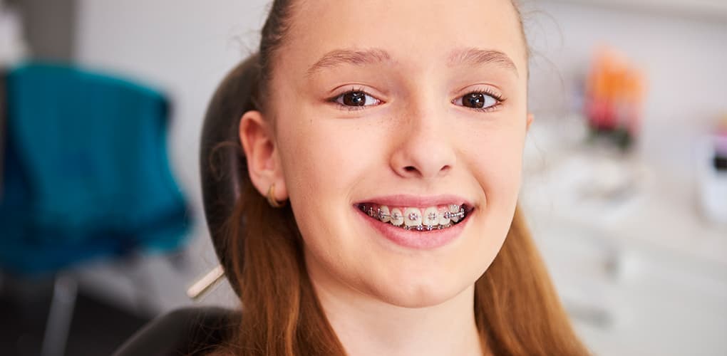 Clear Aligners vs Braces