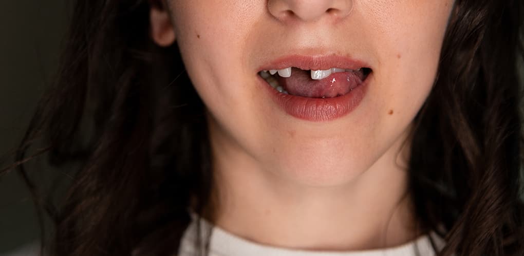 Living With Tooth Loss? Causes, Care, and Options