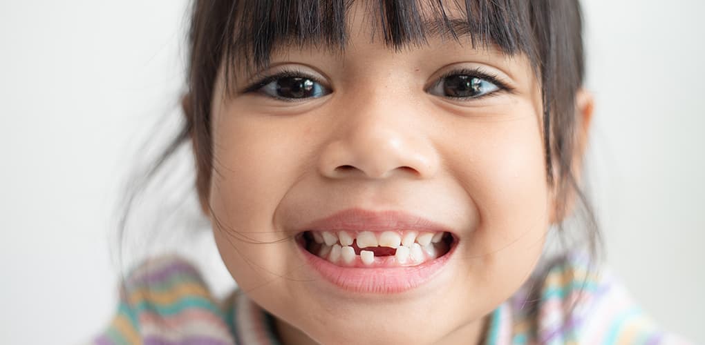 Baby Teeth