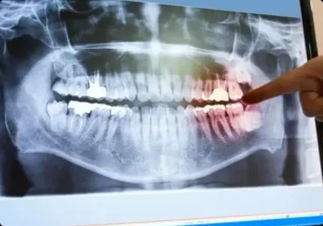3D CT Scan