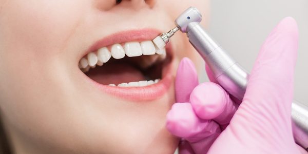 dentist-brushes-teeth-young-girl-teeth-whitening-2021-09-03-07-58-59-utc-min